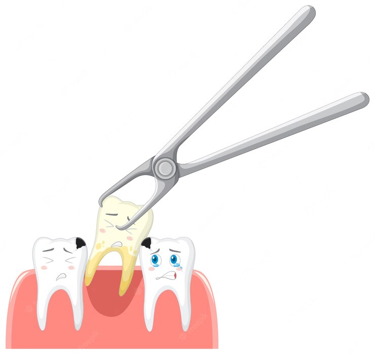 extração dentária